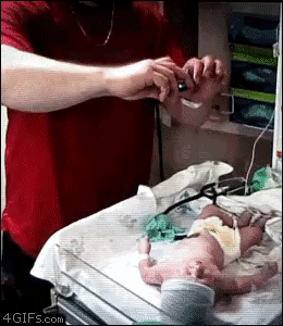 生まれたての赤ちゃんにカメラを落とす